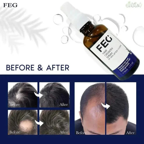 FEG PLUS Hair & Beard Growth Sapray